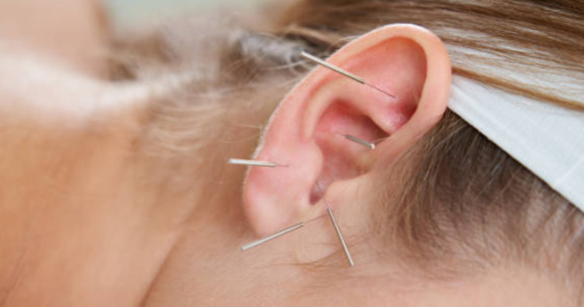 Acupuncture for depression can be used with therapy near me. 